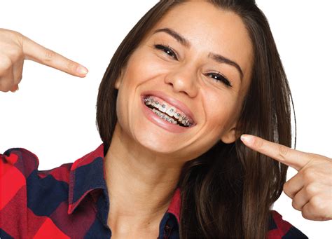 traditional dental braces for adults